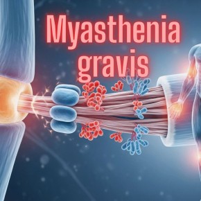 Миастения гравис